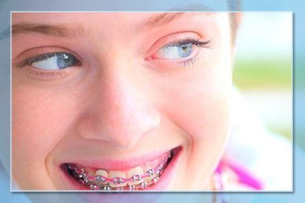 Clínica Dental Parejo niña con ortodoncia